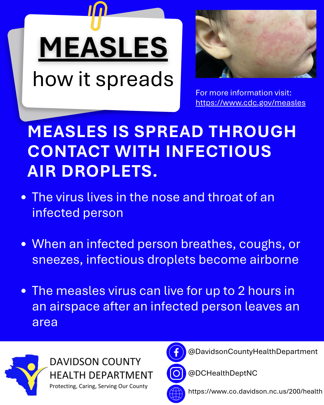 Measles - How it spreads